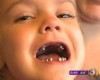 VIDEO: Dentist puts silver crowns on every tooth of four-year-old girl during ‘routine’ procedure