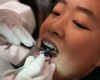 Asian Teens Get Dangerous, illegal fake Braces in Order To Look High Class