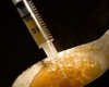 Woman dies after injecting heroin contaminated with Anthrax